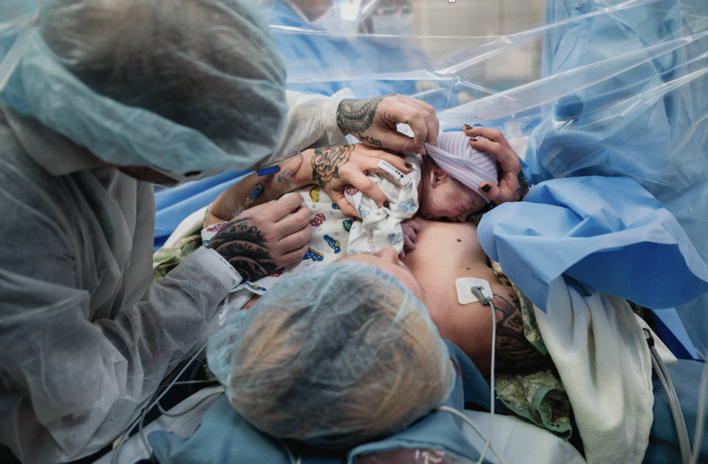 A baby is skin to skin during a cesarean birth.